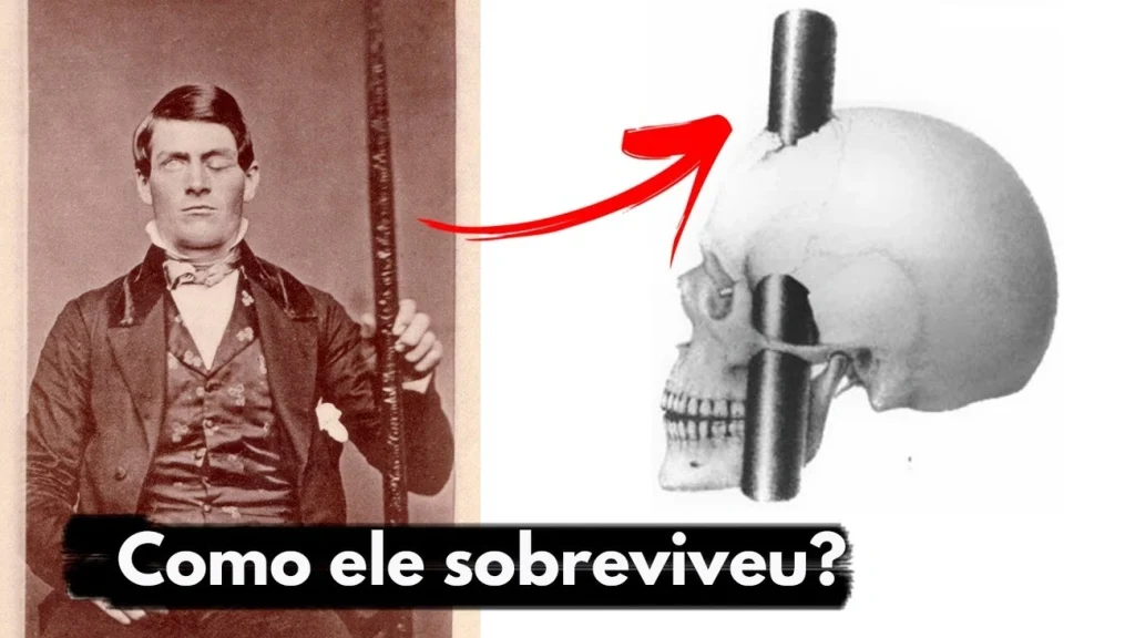 Com uma barra de ferro atravessando o crânio de 90 centímetros, o homem que sobreviveu ao acidente impossível e virou o caso mais famoso da neurociência moderna