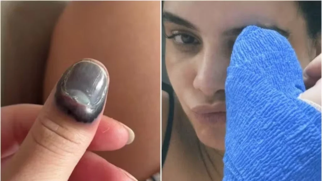 Atriz Carol Macedo passa por cirurgia após prender dedo na porta do carro hoje Atriz Carol Macedo passa por cirurgia após prender dedo na porta do carro hoje