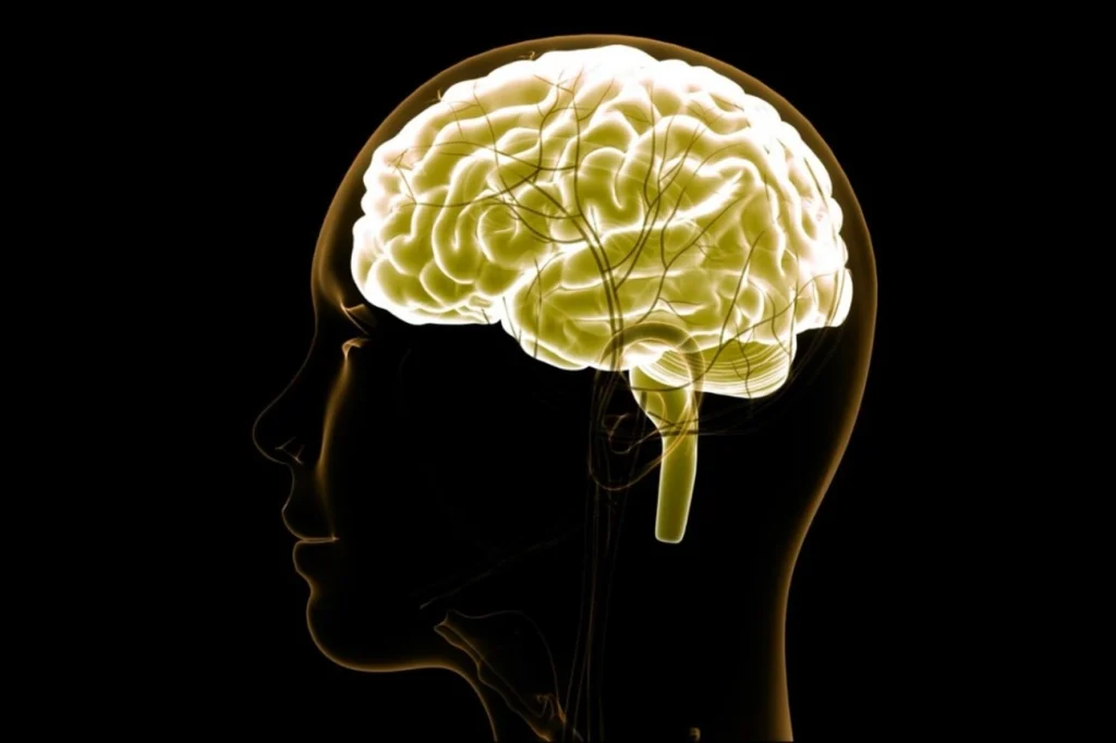 Especialistas explicam diferenças entre AVC isquêmico e hemorrágico Especialistas explicam diferenças entre AVC isquêmico e hemorrágico