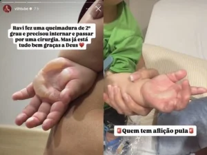Filho de Viih Tube sofre queimadura e faz cirurgia de emergência após acidente hoje