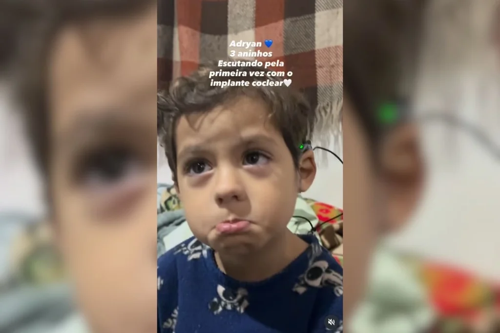 Reação de bebê ao ouvir pela 1ª vez após implante coclear viraliza Reação de bebê ao ouvir pela 1ª vez após implante coclear viraliza