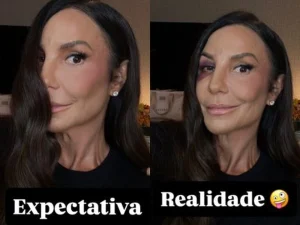 Ivete Sangalo mostra rosto after cair agora