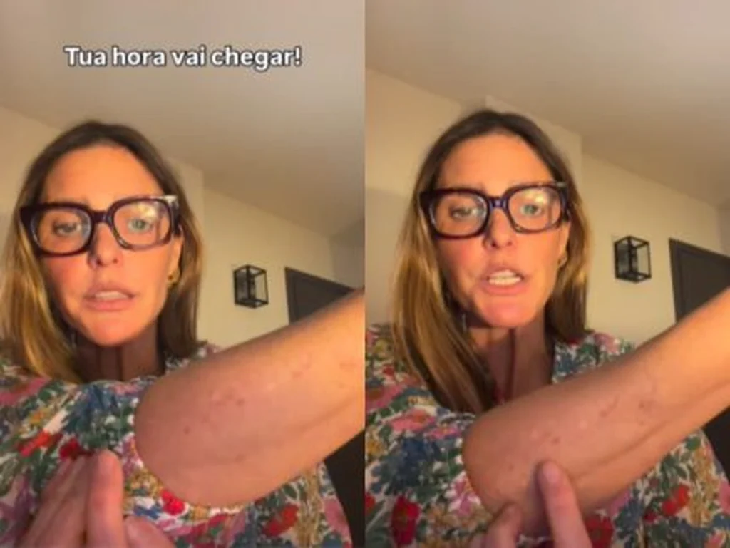 Fernanda Lima, 48, ironiza sobre manchas na pele e envelhecimento