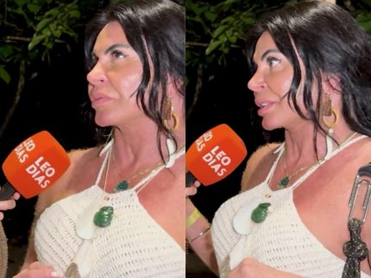 Gretchen Revela a Solução Para a Flacidez Pélvica: Capuzplastia, o Meu Retorno à Confiança