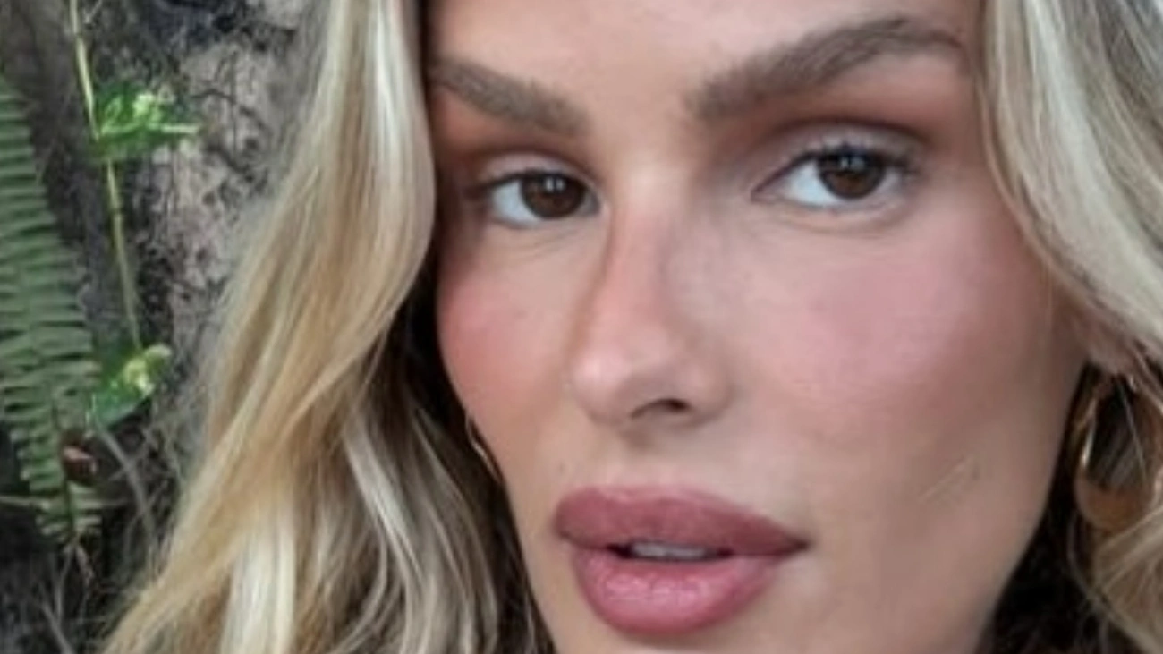 Yasmin Brunet revela surpreendente diagnóstico de doença crônica descoberto por um morador de rua